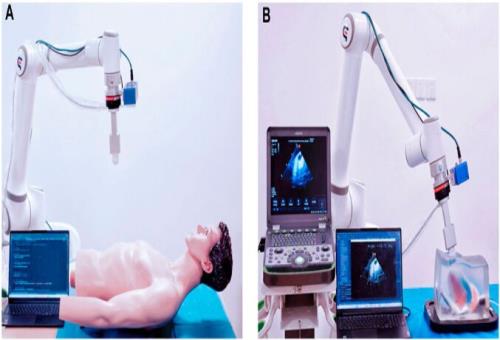 روبات پژوهشگران ایرانی عکسبرداری اولتراساوند را ایمن می کند